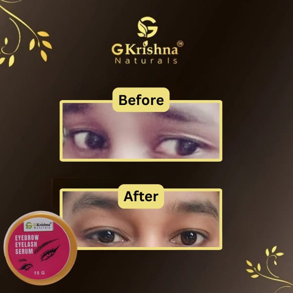 Eyelash & Eyebrow Growth Serum