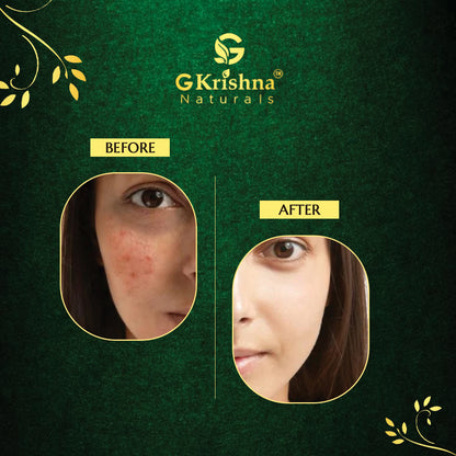 Anti-Black Spot Gel