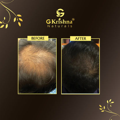Complete Anti Hair Fall Kit