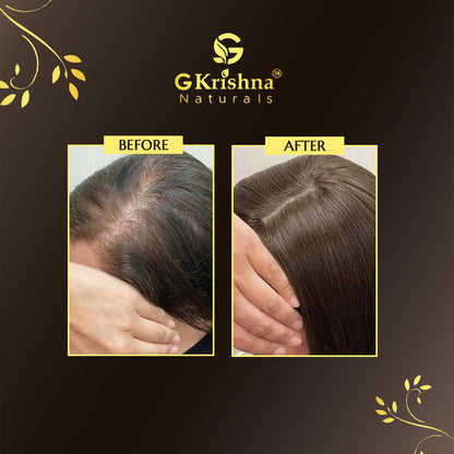 Complete Hair Regrowth Kit